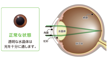 正常な状態