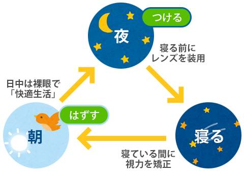オルソケラトロジー治療とは