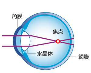 装用前（近視の状態）