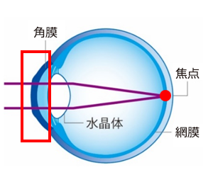 装用後（裸眼時）